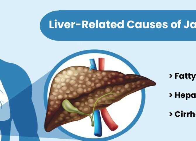 Liver-related causes of jaundice including fatty liver, hepatitis, and cirrhosis