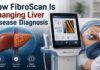 FibroScan test in Pune for liver disease diagnosis by Dr. Vikrant Kale